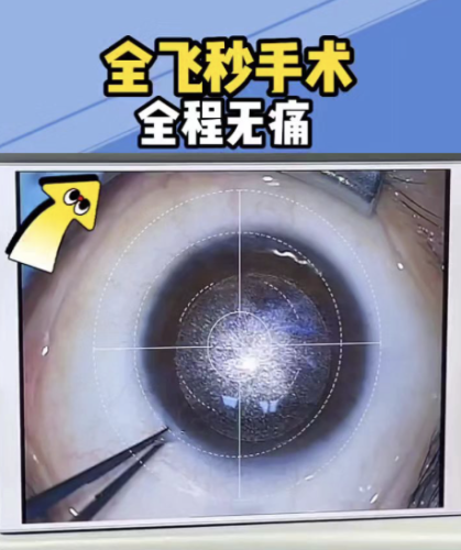 西安飞秒激光手术哪家医院好?2026权威测评+个性化选择指南